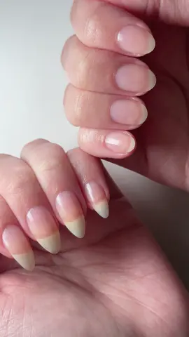 Continuo usando a base Maximus Nail da Blant e a cada dia noto as minhas unhas mais fortes, bonitas e saudáveis. Também comecei a notar um pequeno aumento no crescimento!  Encontre ela no Mercado Livre: MAINA0-TQ92 @Mercado Livre  #MeusFavsDoMercadoLivre #MercadoLivre #unhas #unhasgrandes #unhasfortes #nail #nails  