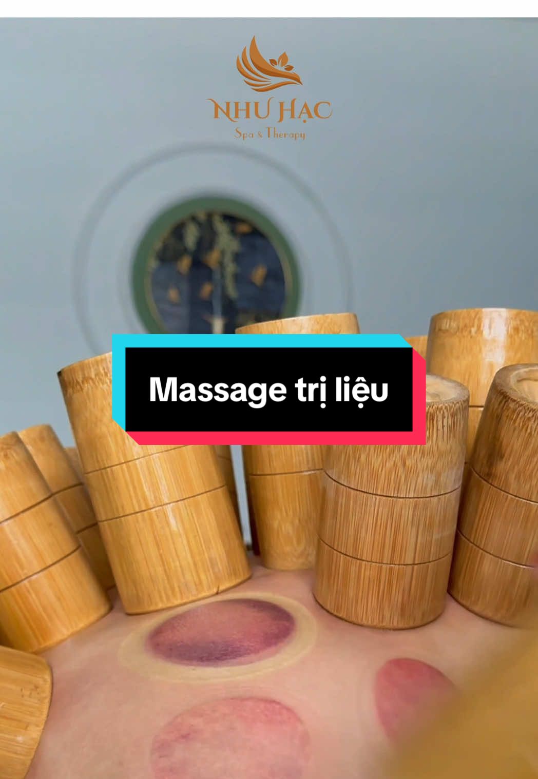 Gội đầu dưỡng sinh Thủ Đức - Massage trị liệu Thủ Đức - Trị liệu cổ vai gáy Thủ Đức - Trị liệu vai cổ gáy Thủ Đức - Trị liệu cổ vai thắt lưng Thủ Đức - Giác hơi Thủ Đức - Cạo gió Thủ Đức - Cạo gió giác hơi Thủ Đức - Giác hơi ống tre Thủ Đức - Massage ASMR #goidauduongsinhthuduc #massagetrilieu #giachoitrilieu #nhuhacspatherapy #trilieucovaigay #xuhuong #thủđức #asmr 