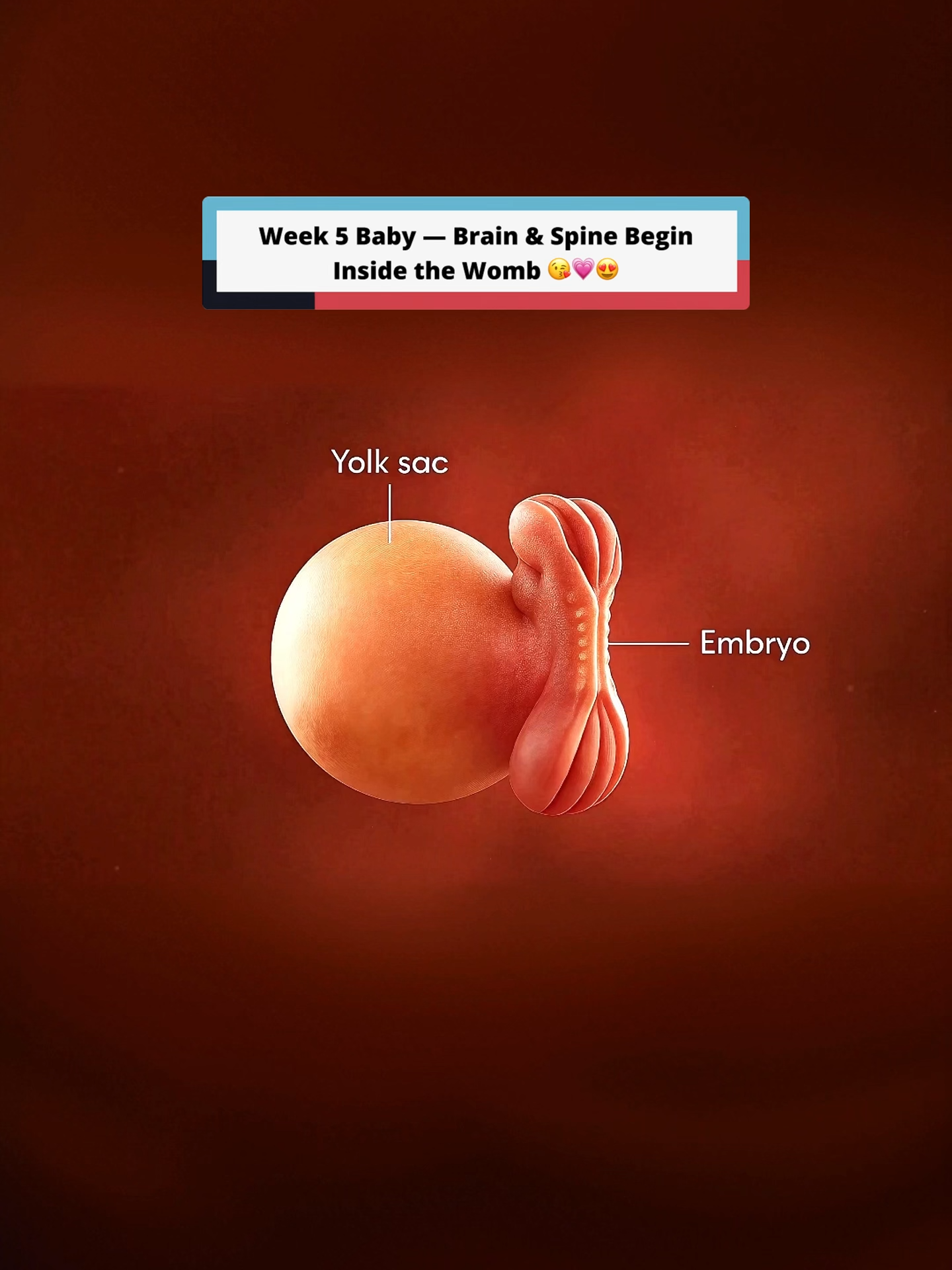 5 Weeks Pregnant — That's How your 5 weeks baby looks inside the womb #pregnancytiktok #pregnancyjourney #pregnanttiktok #pregnantlife #5weekspregnant #5weekspregnancy #babyinsidemomsbelly #babyinsidetummy #babyinsidemytummy #momtobe #firsttimemom #pregnancyapp #pregnancyhealth #babyupdate #babyinsidewomb #fetus #embryo #womb #pregnancy #pregnancyupdate #pregnancyjourney #firstrimester #5weeksbaby #ivfpregnancy #bumpdate #babytalk #5weekold #earlypregnancy #pregnancysymtoms #viral #foryou #foryoupagе #fyp #viraltiktokvideo #prolife #nomoreabortion #abortion #us #unitedstates #UK #unitedkingdom