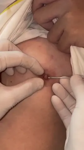 nipple piercing #piercing 