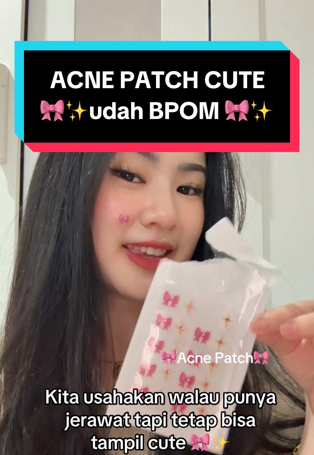 Cequette Acne Patch Lindungin jerawat dari Polusi sama yang imoettt imoett ginii biar selalu tampil Cantikk🎀💓🫵🏻 Udah BPOM ✅ #acnepatch #acnepatchpita #ordernow #stikerjerawat #spill 