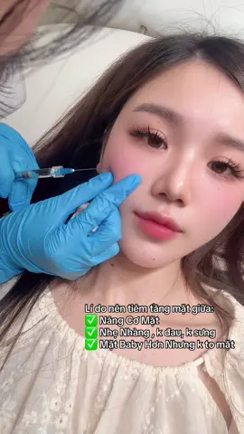 Muốn baby nâng cơ mặt nên chọn dịch vụ tiêm tầng mặt giữa nha các nàng ✅ #khanhhabeautycenter  #fillers💉  #tầngmặtgiữa 
