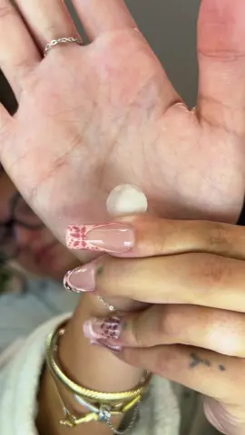 #pimples #pimplepatch 