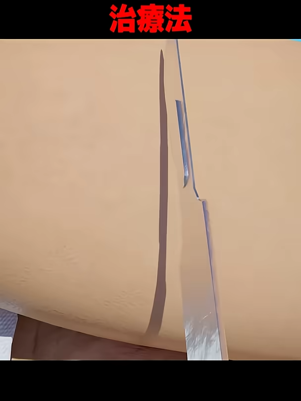 中世医師の治療法