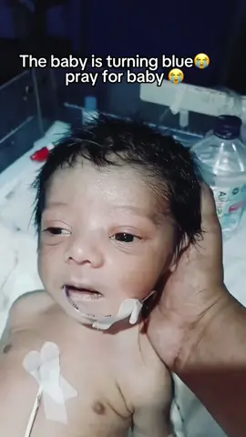 #10millionviews #NICUBaby #NICUCare #NICUWarrior #NICULife #viralvideos #usa🇺🇸 #grmany🇩🇪 #uk #PrematureBaby #nicujourney #