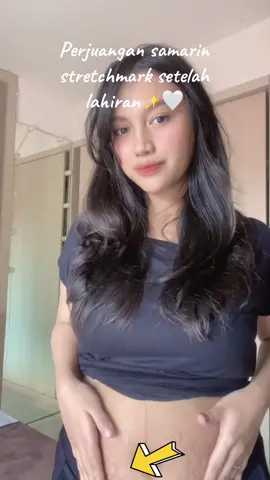 My holy grail so far🤎🤎🤎‼️ #stretchmarks #stretchmark #stretchmarkserum #stretchmarkoil #ciaraindonesia #bumil #busui #postpartum #postpartumbody #pregnantlife 