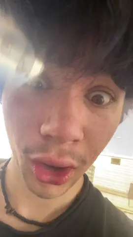 Bruh I’m so bored, and I have no flexibility in my hips, I suck at dancing😔