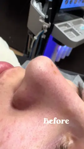 #CapCut 