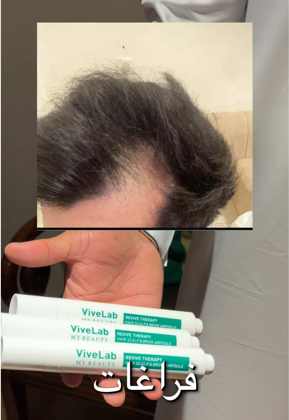 انقذوا شعورهم ‼️  #ماي_بيوتي #mybeauty #سيروم_فايف_لاب 