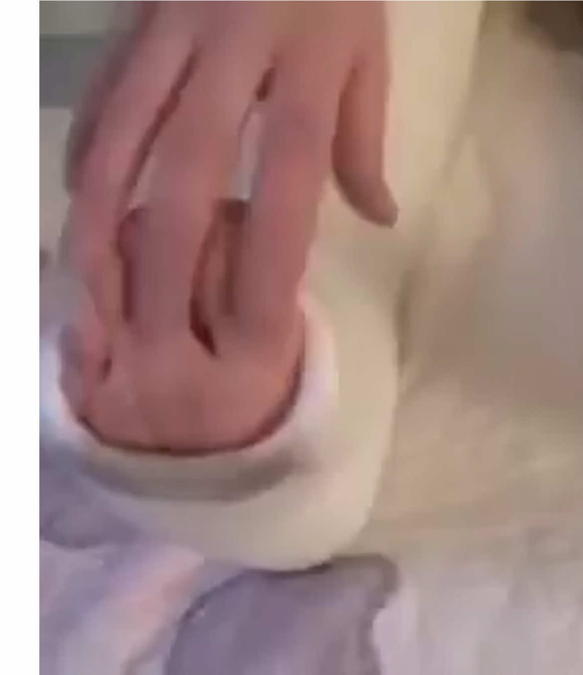 Itchy itchyyy😋🥰 #fypシ゚viral #foot #cast #cast #Love 