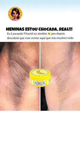 O clareador de banana é um tratamento 10 vezes mais potente e pode ser usado em olheiras, melasma leve, axilas, virilhas, bumbuns, joelhos, cotovelos e até na região íntima. O único no Brasil com essa tecnologia #adeusclareadordebanana #clareadordemanchas 