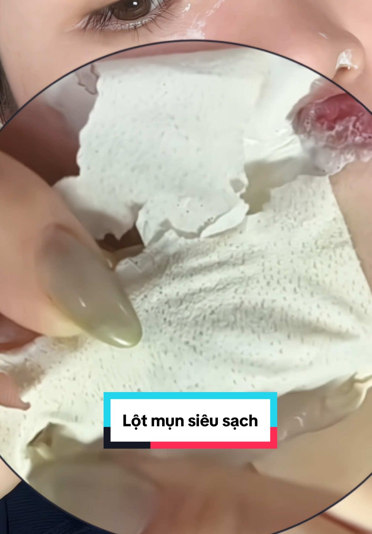 Ai nhiều mụn cám , mụn đầu đen thì phải tậu ngay chai lột mụn gel nha đam của nhà Lucky Star nhé . Dễ lột , ra được rất nhiều mụn , mà giá lại hạt dẻ #lotmun #lotmundauden #skincare #luckystar #xuhuong 