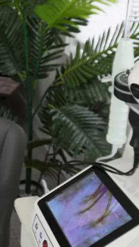 ASMR part 15: scalp exam wellness assessment | medical roleplay for sleep and relaxation #madpasmr #asmrscalp #asmrscalpcheck #asmrsharpordull #asmrmedical #asmrmedicalroleplay #asmrmedicalexam #asmrdoctor #asmrdoctorroleplay #asmrrealperson #asmr #asmrsounds #asmrsensory #asmrroleplay #asmrvideo