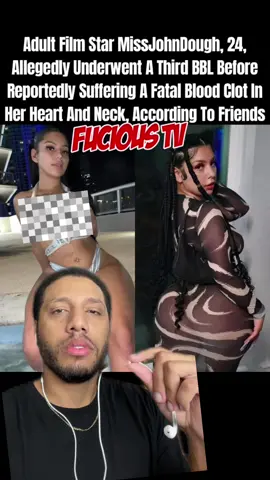 Not here to pass judgement but put a light to the #situation #bbl #surgery #surgerytiktok #surgerytok #mago13 