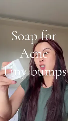 Lalayo ka pa ba? Eto reseta ng DERMA. #acnetreatment #acne #skincare 