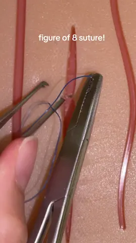 the figure of 8 suture is probably my favorite suture ever! #surgeon #highschoolstudent #fypシ゚viral #surgerytok #student #highschool #surgerytiktok #healthcare #fyp #suturekit #suturepad #surgery #suturepractice #suture #usa #makemefamous #surgeonsoftiktok 