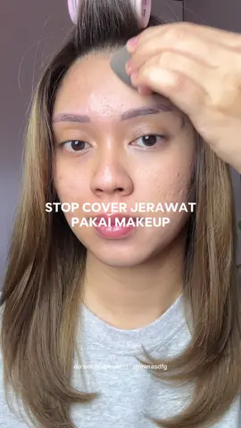 jangan asal tutupin jerawat pakai makeup karena nanti bisa jadi meradang pakai acne patch aja sebelum pakai makeup complexion found me an ultra thin, seamless & invisible acne patch from local brand : Npure💚 Wajib ngestock sih! #acnefighter #acnefighterindonesia #acnepatch #pimplepatch #npure 