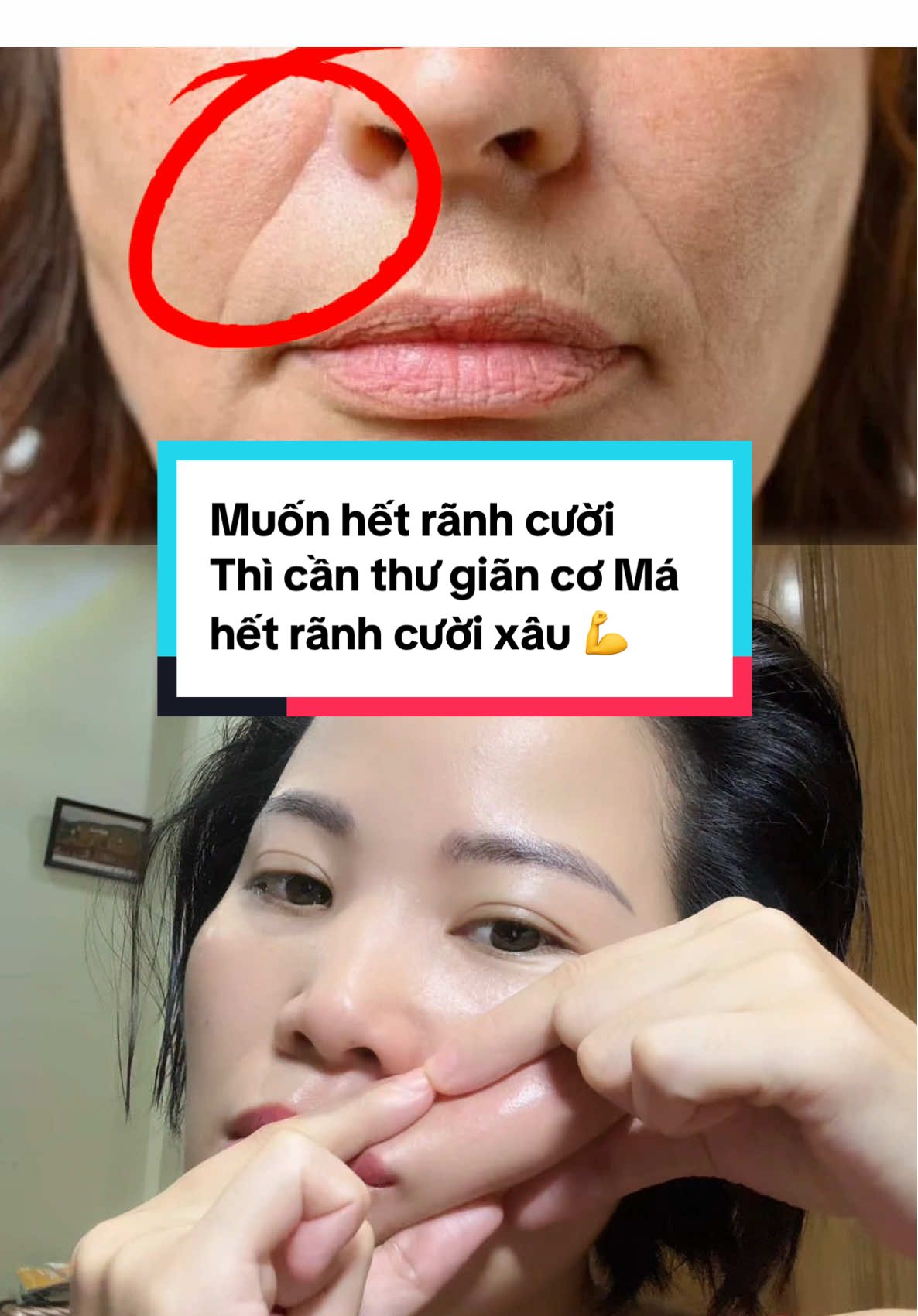 Cải thiện rãnh cười xâu/ râu rồng bằng bài tập này nhé. #yoga #yogaface #botox #xuhuong #ranhcuoi #guasha  @Share kiến thức Face Yoga MGP 