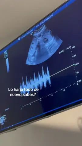 Mi pedacito de carne 🤍🧸#paratii #bebe #mamaprimeriza #hijo #fyppppppppppppppppppppppp 
