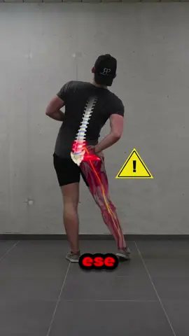 #sciatica #sciaticarelief #sciaticapain #jointpain 