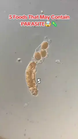 5 Foods That May Contain Parasites (and Most People Have No Idea) ⚠️🦠 Think your plate is safe? Think again: 🍣 Sushi 🥩 Undercooked Meat 🥬 Unwashed Leafy Greens 🍓 Berries 🚰 Tap Water Always wash, cook, and filter — your gut health depends on it! #ParasiteAwareness #GutHealth #FoodSafety #HealthTips #WellnessWarning 