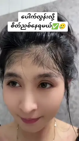 ရှယ်ထူ #ccအမွှေးပေါက်ဆေး #doublehotbiohairserum #အမွှေးပေါက်ဆေး #ဆံပင်ပေါက်ဆေး #ထိပ်ပြောင်ဆံပင်ပြန်ပေါက်ချင်သူများအတွက် #အာမခံအမွှေးပေါက်ဆေး 