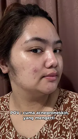 cobain deh buat cerahin wajah @ZOICY Skincare 😍 #zoicy  #zoicyskincare #zoicysheetmask #sheetmask #hyaluronicacid 