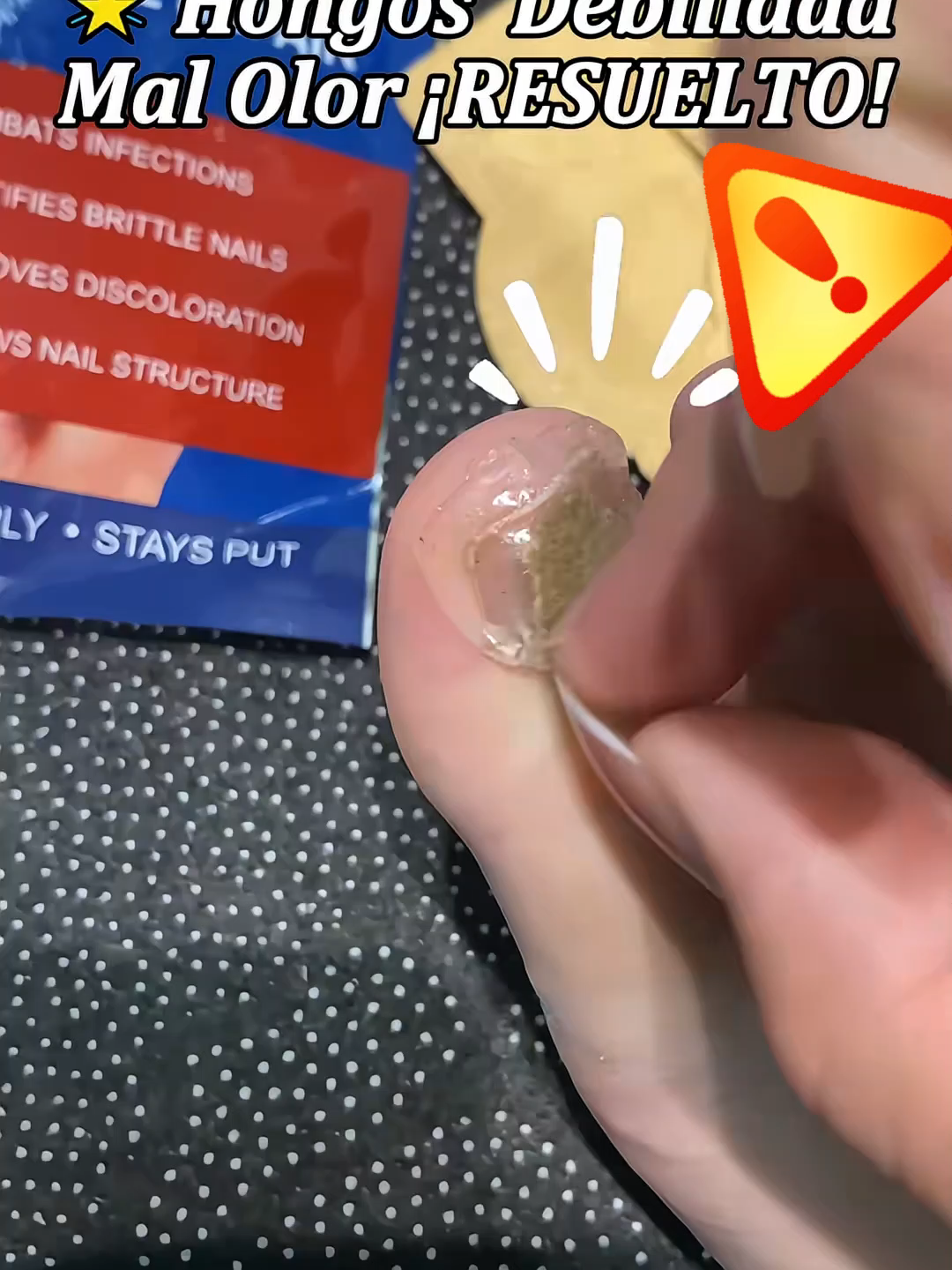¡De VERGÜENZA a PERFECTAS en 3 semanas! Así cambiaron mis uñas 🎥#elaimeifungalnailspatch #fungalnailtreatment #beforeandafter #tiktokmademebuyit #tiktokshopbacktoschool #nailcare #nails💅 #nailcaretips #toenails #fungalnail #elaimei #fyp