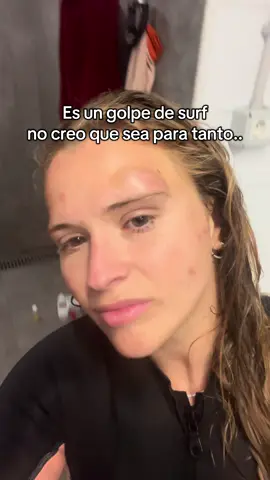 Hace un mes de este acontecimiento #surf #accidente #fyp 