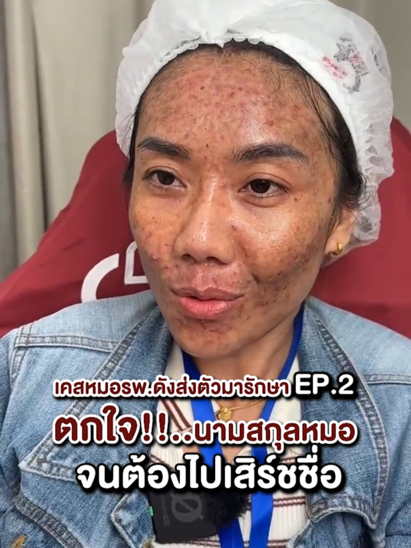 เคสหมอรพ.ดังส่งตัวมารักษาEP.2 ตกใจ!!นามสกุลหมอจนต้องไปเสิร์ชชื่อ #doctornatclinic #รีวิวเคสจริงdrnat #รักษาสิว #รอยสิว #acneresolved #ไม่ขายคอร์ส #ไม่มีคอร์ส #Acclear