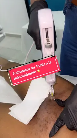 Traitement du Pubis reste un traitement comme un soin de visage normal. Nous vous faisons une Vajacial, extraire tous les points noirs et les poils incarnés puis ont appui avec la Mésothérapie qui traite en profondeur les imperfections. Sur cette vidéo nous avons directement intervenu à la mésothérapie. Les résultats sont rapidement visibles dans la semaine.  nous sommes situés à DOUALA Bonapriso, en face de la clinique, métropolitaine, ancien dépôt Guinness  📞+237688999999 ##camerountiktok🇨🇲##mslloge##beautyclinic