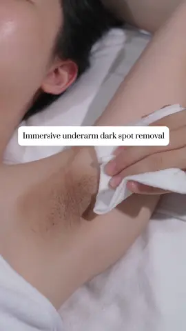 Immersive underarm dark spot removal. #relax #relieve #massage #skintreatment #skincare #facespa #cleanface #foryou #spa #asmr #treatments #relievepressure #asleep 