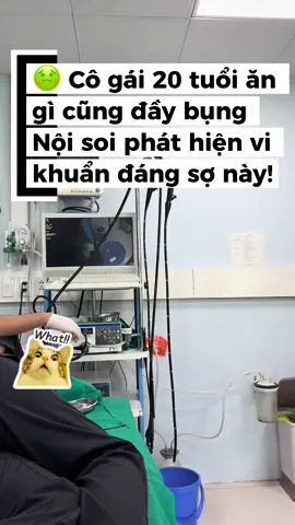 BN nữ 20 tuổi đi khám vì đầy bụng, khó tiêu. Nội soi phát hiện viêm niêm mạc dạ dày và test urease dương tính với vi khuẩn HP. Đây là nguyên nhân hàng đầu gây loét dạ dày – tá tràng và là yếu tố nguy cơ cao gây ung thư. ❗ Nếu bạn có triệu chứng tương tự, đừng chủ quan – hãy nội soi và điều trị sớm để tránh hậu quả nghiêm trọng !! #xuhuong #viral #tiktok #bscuongnoisoi #vikhuanhp #songkhoe #khotieu 