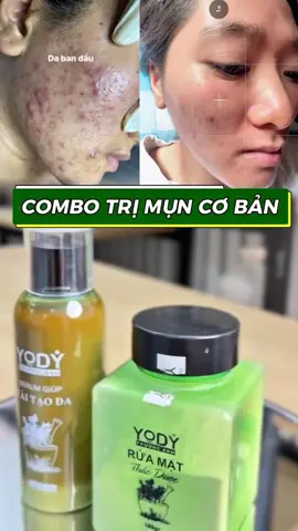 Mụn sợ combo này nè cả nha !!###tinhchathutsactonamtannhang #xuhuongtiktok2025 #peelda #lamdeptainha #taitaoda #botruamatthaoduoc 