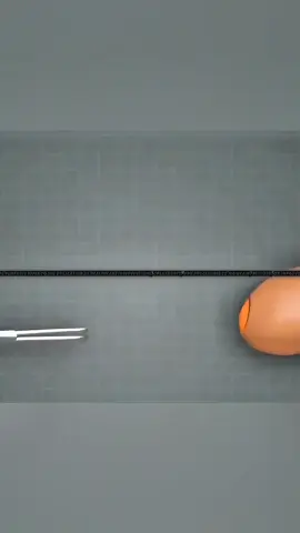 Circumcision Surgery procedure #animation #circumcision #surgery #medical #health 