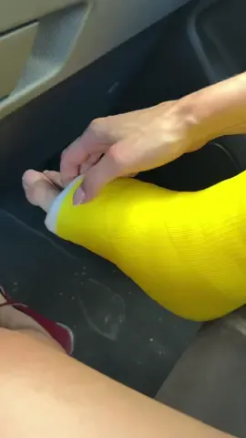 Rosie. Patreon.com/swisscaster #slc #plaster #gipsbein #platre #siliconebreasts 