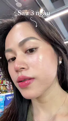 1 em serum B5 phục hồi siêu đỉnhhh #ekseption #serum #serumekseption #b5 #skincare 