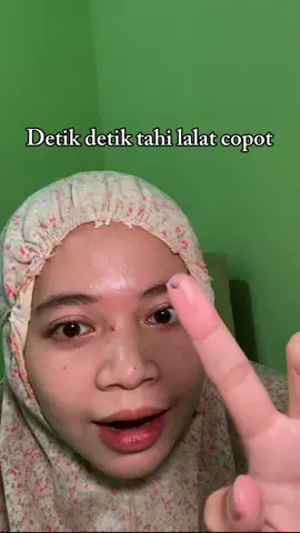 Membalas @Vhazaguns akhirnya copot tahi lalat ku