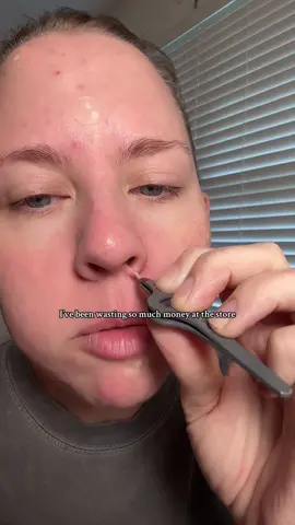 If I see you buying the ones at the store, ima yell at you #pimplepatches #pimplepatchremoval #spottreatment #acneproneskin 