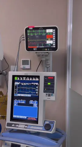 Quais sinais vitais você consegue visualizar no monitor ? SOBRE PARADA CARDÍACA  Em parada cardíaca intra-hospitalar, o passo inicial correto depende do contexto — mas de forma prática, no ambiente hospitalar, você inicia compressões torácicas imediatamente assim que constatar ausência de pulso central e inconsciência, enquanto outra pessoa aciona o time de resposta rápida / código azul e traz o carrinho de emergência. O fluxo intra-hospitalar segundo o ACLS (AHA 2020) é: 	1.	Reconhecer a parada cardíaca → paciente inconsciente, sem respiração normal e sem pulso carotídeo ou femoral (verificação ≤ 10 segundos). 	2.	Iniciar compressões torácicas imediatamente (profundidade 5–6 cm, frequência 100–120/min, permitir retorno completo do tórax). 	3.	Acionar ajuda → chamar o código azul, pedir DEA/desfibrilador e carrinho de emergência. 	4.	Ventilação → se houver equipe treinada e material disponível, iniciar ventilação com bolsa-válvula-máscara após 30 compressões (ou 2:30 se já com via aérea avançada). 	5.	Monitor/desfibrilador → assim que chegar, conectar e verificar o ritmo para decidir se é choqueável (FV/TV sem pulso) ou não. 	6.	Seguir algoritmo ACLS (adrenalina, amiodarona, desfibrilação, causas reversíveis etc.). 📌 No hospital, a vantagem é que o atendimento costuma ser quase simultâneo: enquanto um inicia compressões, outros já preparam o monitor, via aérea e drogas. Se quiser, posso te fazer um resumo visual do algoritmo ACLS intra-hospitalar pra você lembrar na hora do plantão. #saude  #enfermagem #enfermagemnotiktok #nurse #healt #emergency #uti 