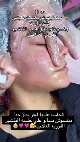 #جلسه #التقشير #الفوري #GamingOnTikTok #CapCut #skin #skincare #skincareroutine #skinwalker #SkinCare101 #skintok #skills #بشره #بشره_صحيه #بشره_دهنيه #بشره_مشدوده #hair #hairstyle #hairtok #haircare #بشره_نظيفه #فرد_الشعر #فرد #حدائق_القبه #حدائق_القبه🔥 #الزاويه #الزاويه_الحمراا #القاهره #القاهره_مصر🇪🇬 