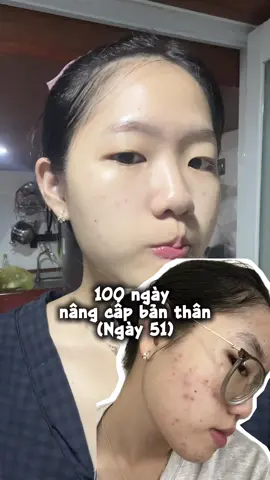 Ngày 51/100. Mình có đi nặn mụn nhưng không thường xuyên, chỉ những cái mụn chai và mụn viêm già mình mới đi nặn để k bị tái viêm, còn mụn ẩn thì mình sẽ k nặn vì nó tự xẹp được á.  Cách mình chăm da sau nặn mụn: - kiêng skincare 2 ngày đầu - lau mặt bằng NMSL, hoặc nước lọc - đắp mask lành tính, serum phục hồi và bôi kem trên vết thương to để ngừa sẹo.  Nếu hong biết chăm hoặc k có đồ chăm sau nặn mụn thì đừng nên đi đâu 🥺 #mituueh