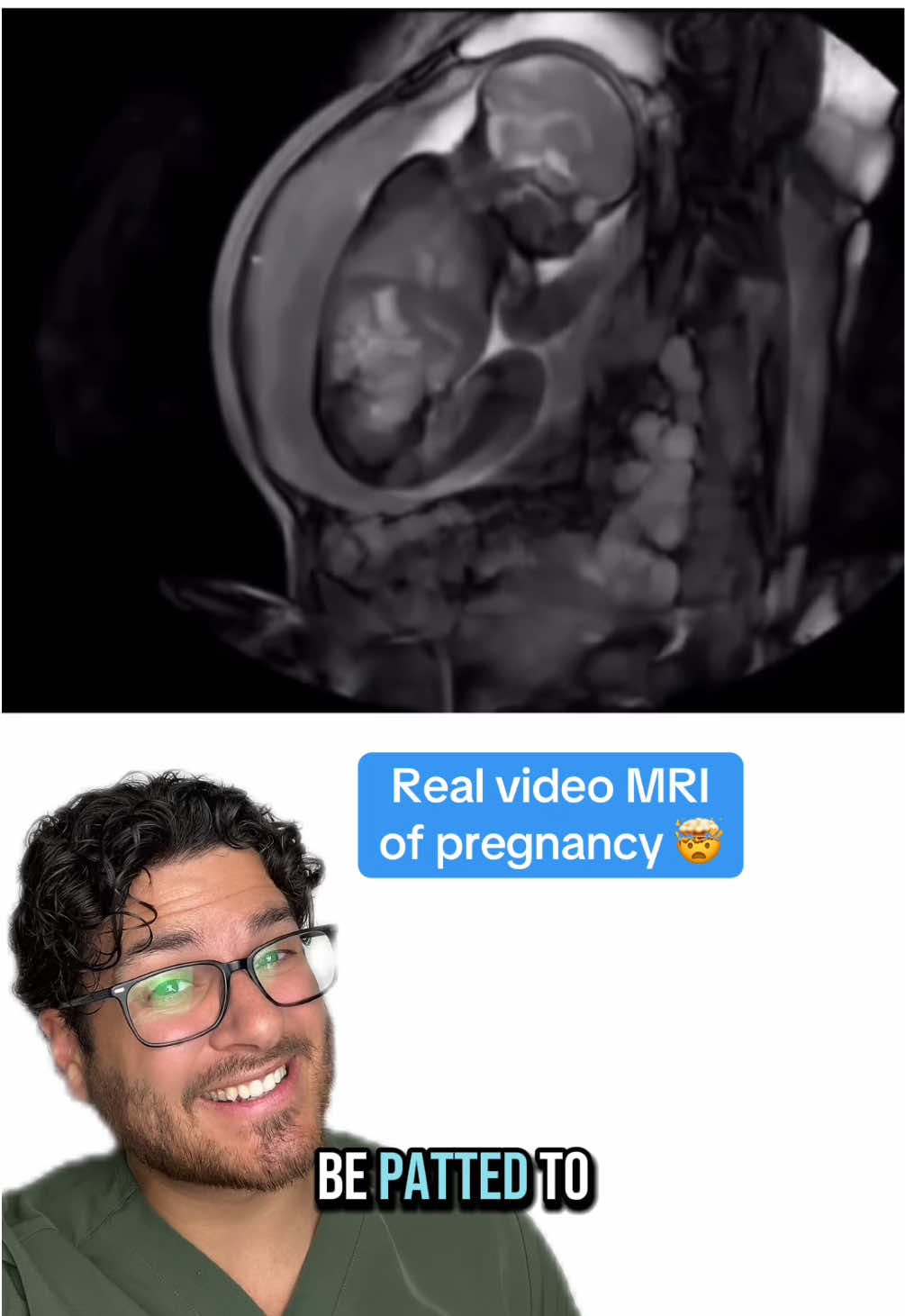 It really doesn't get much more adorable than this for imaging studies 👼🏻🥹