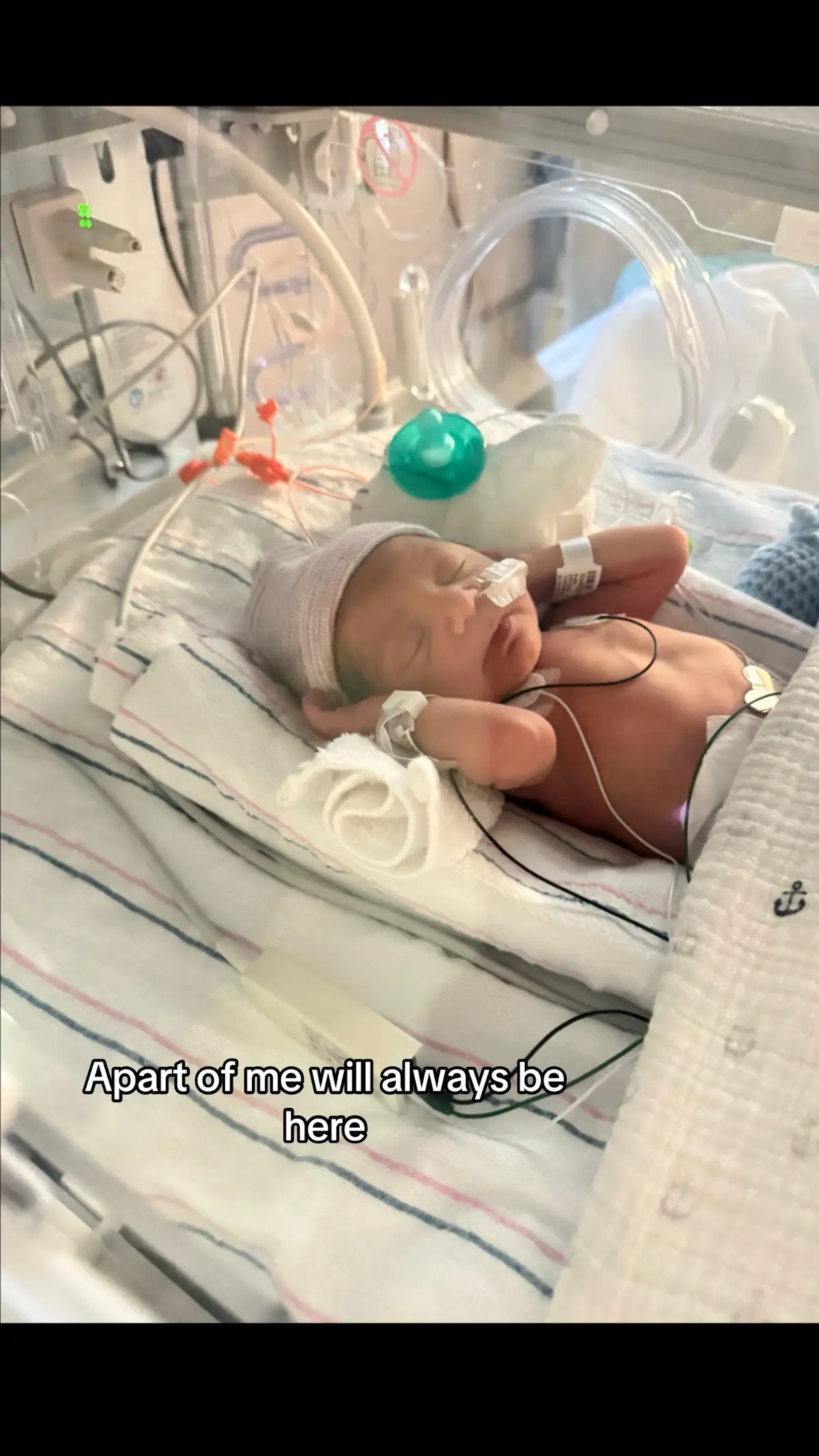 I’m so glad you’re home and healthy ml but I always think about our nicu days my heart still hurts #nicu #postpartum #preemie #nicubaby 