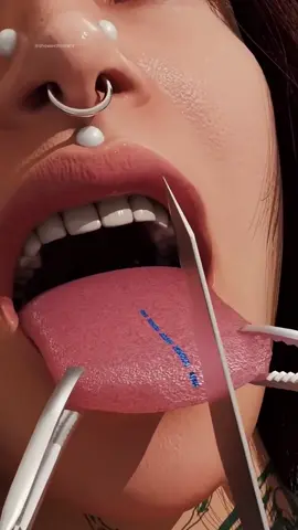 How Tongue Splitting Is Done