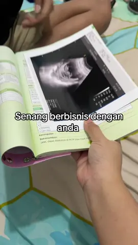 Waduu bisnis paku pakuan 😆 Nnti saya bikinin yg byk🤣 @Y_teamsyndicate  #pregnant #masyaallahtabarakkallah 