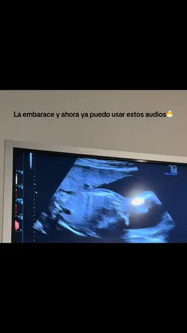 Mi orgullo más grande #bebe #bebeencamino #embarazofeliz #teamdiciembre🤰💖 @La faby 