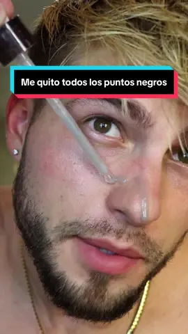 Esto me ayudo un montón #blackhead #tiktokmademebuyit #skincare #tiktokshop 