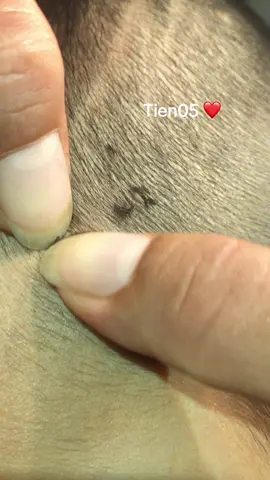 Remove lice #olebrandselect #lice #omg ❤️❤️❤️❤️#omg 