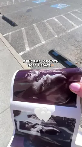 Entering my 36th week of pregnancy with peace! Time to focus on nesting🙌🏼  #36weekspregnant #37weekspregnant #38weekspregnant #pregnant #thirdtrimester 